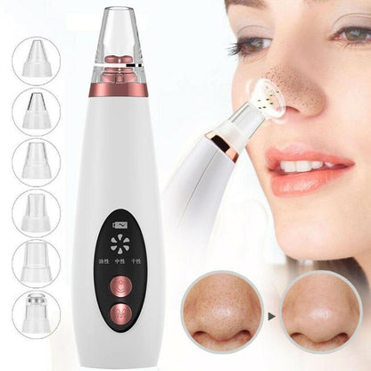 Blackhead Remover Pore Vacuum – Nose Cleaner, Acne Removal Suction Tool for Clear Skin